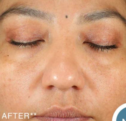 glowTone™ Corrective Serum